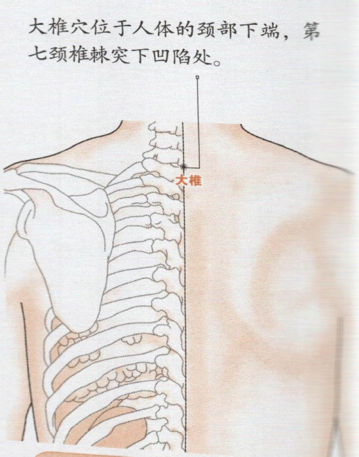 大椎穴位的准确位置图 大椎穴位图 大椎穴