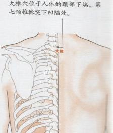 大椎穴位位置图 大椎穴位在哪